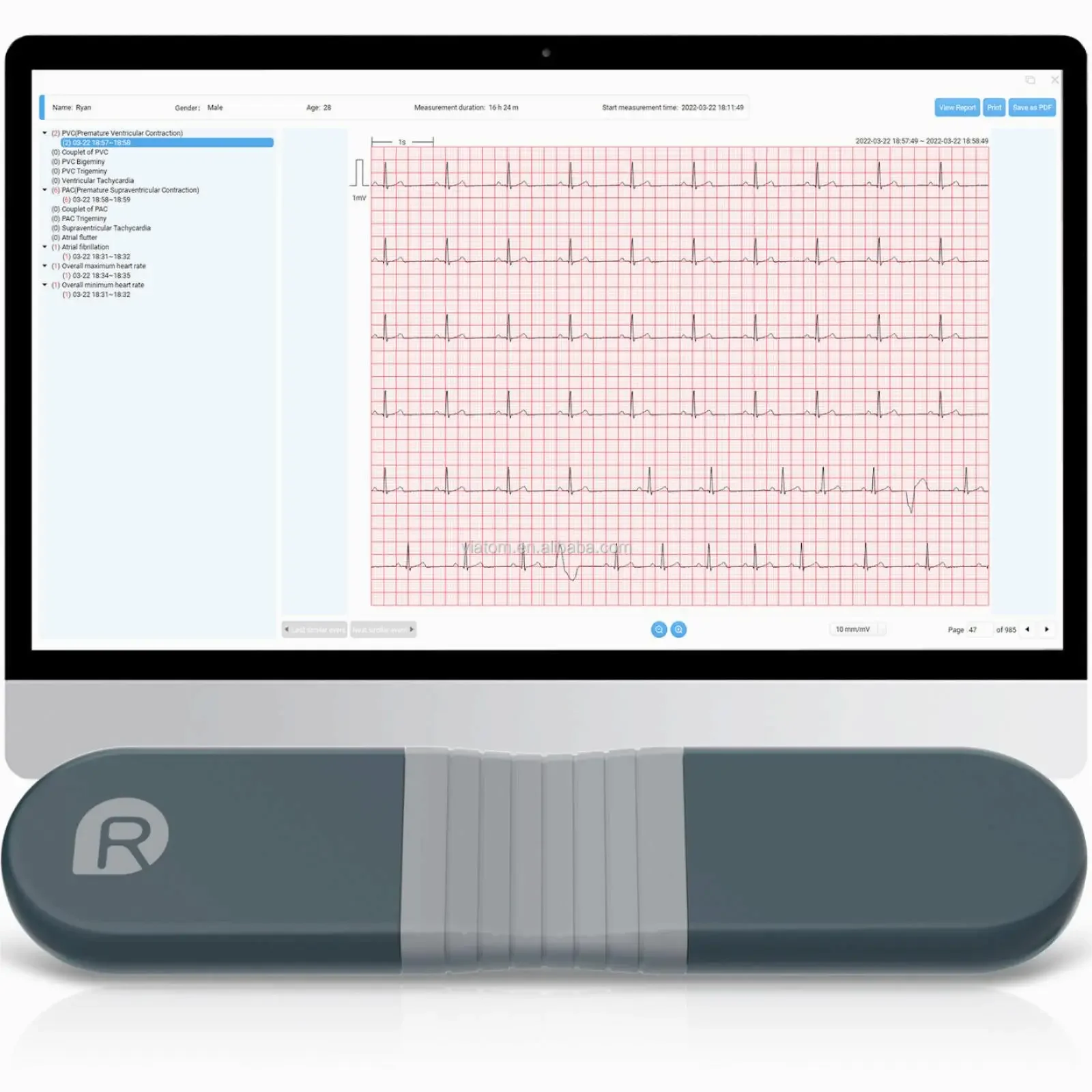 Wireless Bluetooth Dynamic Rec - огляд і ціна Ecg Patch Monitor